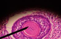 BPA Can Disrupt Human Egg Development, Study Shows